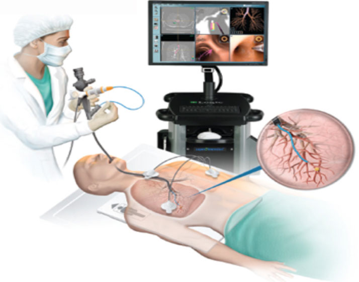 Bronchoscopy 1