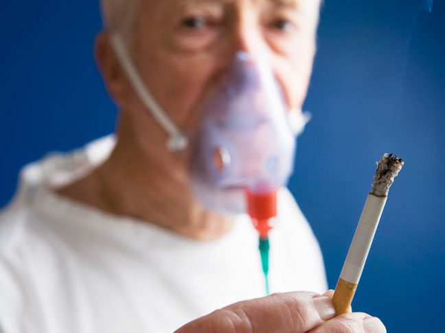 COPD (Emphysema and chronic bronchitis) 1